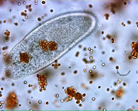  Paramecium: Un Microrganismo Che danza con Eleganza e Degusta Alghe come un Buon Vino!